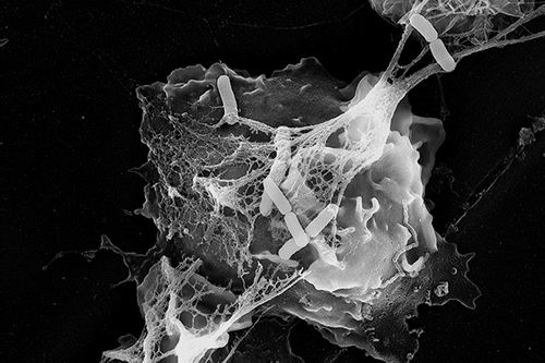 免疫细胞织"网"诱捕细菌